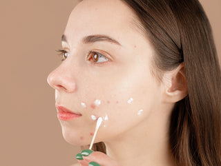 Pimple Panic and Predicaments: Toothpaste to the Rescue?