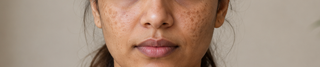 How to Reduce Pigmentation: Best Ingredients and Skincare Routine That Actually Works