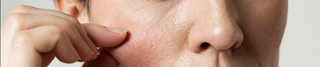 7 Signs Your Skin Is Dehydrated (And How to Fix It)