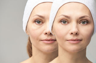 Say Goodbye to Fine Lines: The Power of Argireline Peptides for Skin